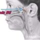 Adenoidid: Symptoms, Causes, Diagnosis, and Treatment
